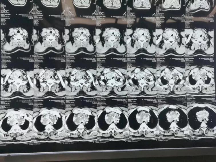 1560306889622198.jpg 1.jpg