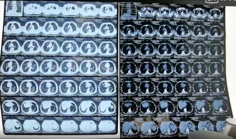 1604282348278724.jpg 3.jpg