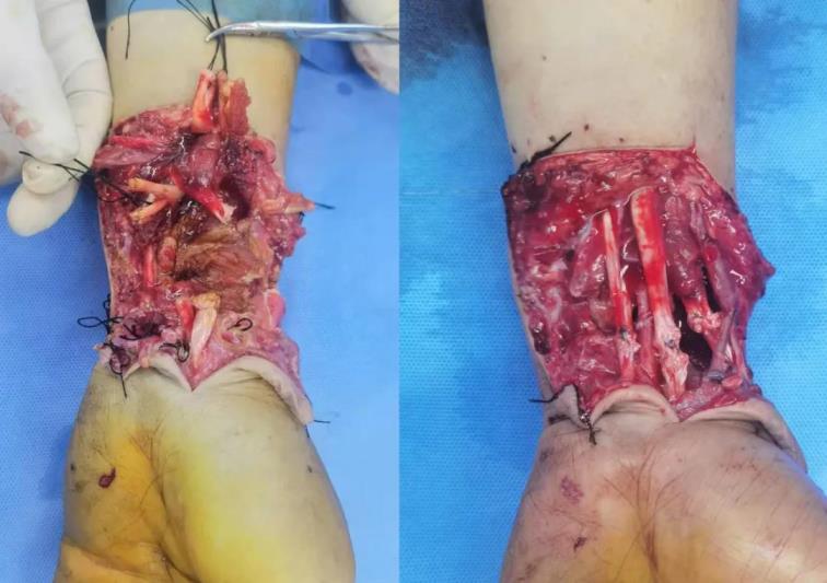 1606018230337256.jpg 3.jpg