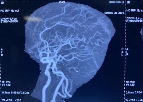 1608508586980573.jpg 3.jpg